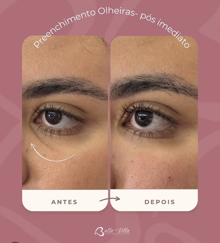 Clínica BellaVitta - Estética Avançada - Clínica de Estética em Boqueirão, Curitiba/PR - Foto 2