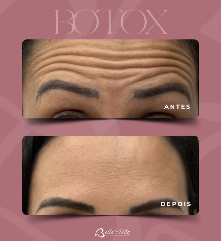 Clínica BellaVitta - Estética Avançada - Clínica de Estética em Boqueirão, Curitiba/PR - Foto 3