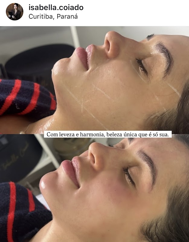 Clínica BellaVitta - Estética Avançada - Clínica de Estética em Boqueirão, Curitiba/PR - Foto 4