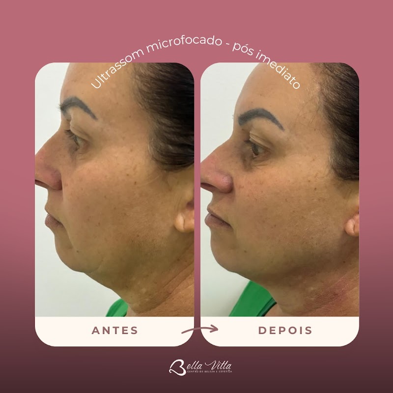 Foto 6 de Clínica BellaVitta - Estética Avançada
