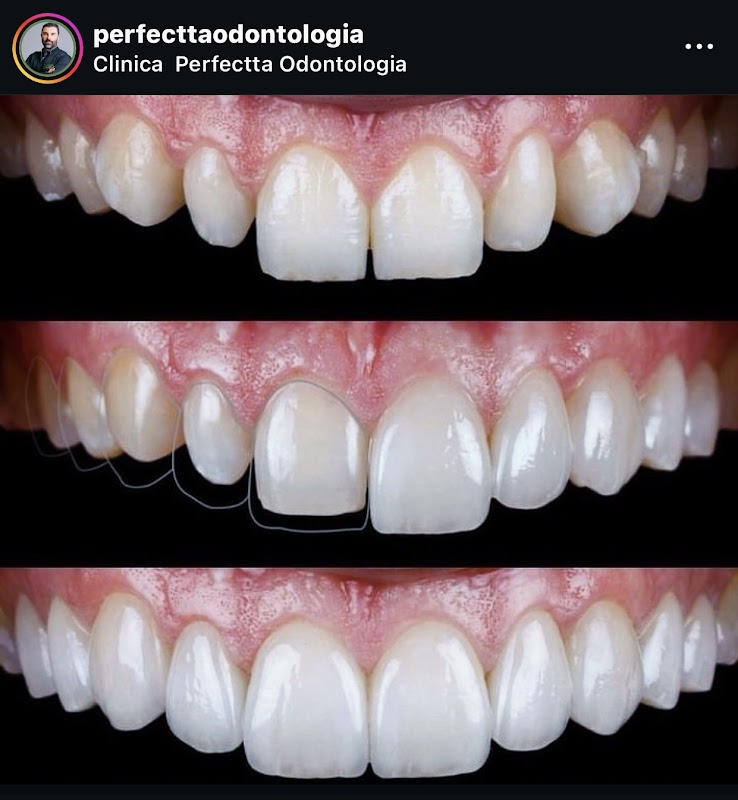Clinica Perfectta Odontologia - Clínica Odontológica em Centro, Curitiba/PR - Foto 3
