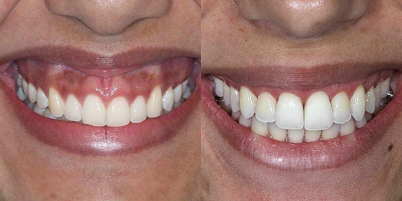 Neo Sorriso - Clínica Odontológica - Clínica Odontológica em Centro, Curitiba/PR - Foto 5